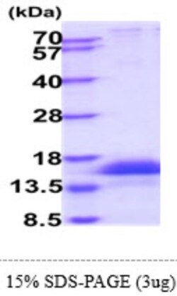 Novus Biologicals&trade;&nbsp;Recombinant Human CD3 zeta Protein